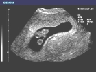 Embryo mit Dottersack